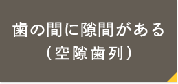 歯の間に隙間がある（空隙歯列）