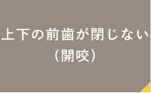 上下の前歯が閉じない（開咬）