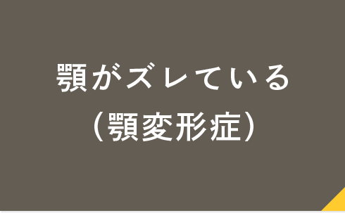 顎がズレている（顎変形症）