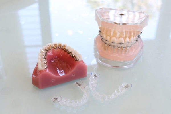 矯正歯科治療に伴う一般的なリスクや副作用について